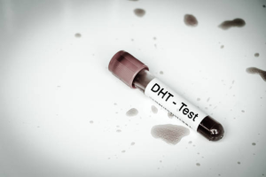 What Does Testing for DHT Levels Reveal About the Potential Causes of Hair Loss?