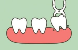 Using 8 Abington Dental Strategies Like The Pros