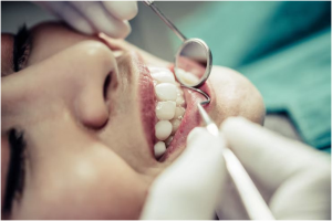 Recovery Guide: Treating Burned Gums from Teeth Whitening Safely