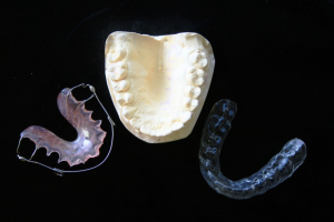 How To Avoid Demineralization While Using Invisalign?