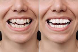 Why Cosmetic Dentistry Is About More Than Just Looks Why Cosmetic Dentistry Is About More Than Just Looks