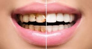 Restorative Dentistry